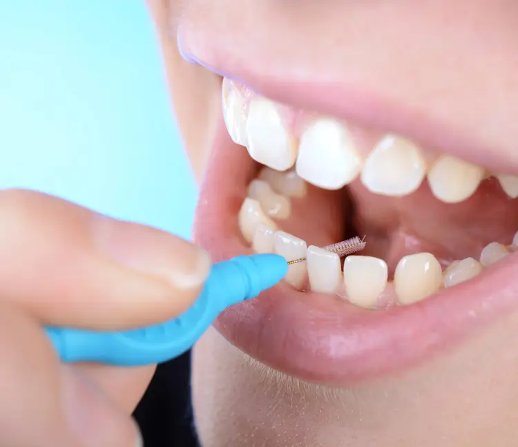 &bdquo;Nahaufnahme eines Mundes, in dem eine Person mit einer blauen Interdentalb&uuml;rste die Zahnzwischenr&auml;ume reinigt